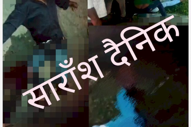 सड़क दुर्घटना में घायल युवको की हालत गंभीर एक आईसीयू में 