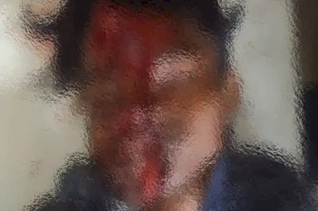ट्रैक्टर के धक्के से एक की मौत एक घायल 