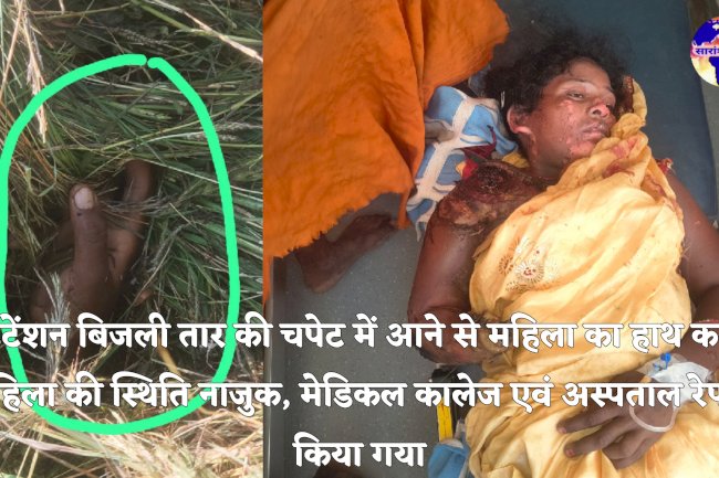 हाईटेंशन बिजली तार की चपेट में आने से कटा महिला का हाथ