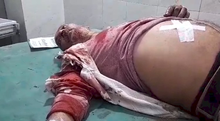 पेट्रोलपंप कर्मचारी को छुरा मार कर लाखो की लूट 