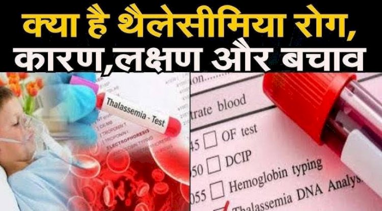 थैलीसीमिया उपचार और खर्च की वास्तविकता