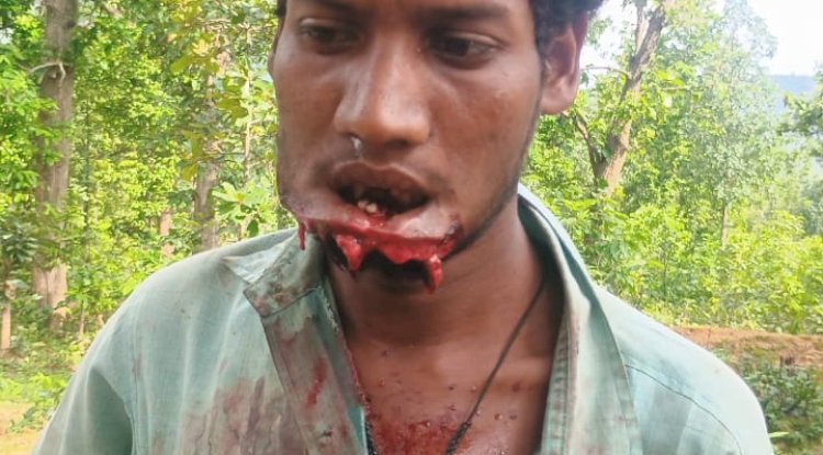 अज्ञात लोगों ने युवक के साथ मारपीट कर जबडा़ फाडा़ 