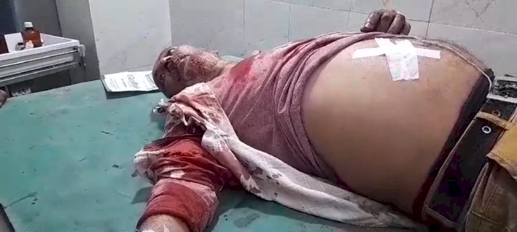 पेट्रोलपंप कर्मचारी को छुरा मार कर लाखो की लूट 