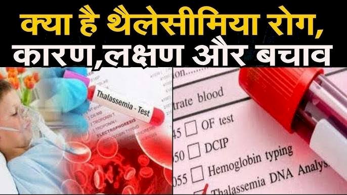 थैलीसीमिया उपचार और खर्च की वास्तविकता
