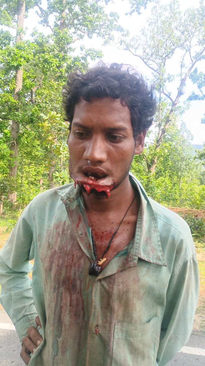 अज्ञात लोगों ने युवक के साथ मारपीट कर जबडा़ फाडा़ 