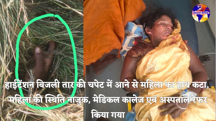 हाईटेंशन बिजली तार की चपेट में आने से कटा महिला का हाथ